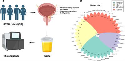 Urinary microbiota signatures associated with different types of urinary diversion: a comparative study